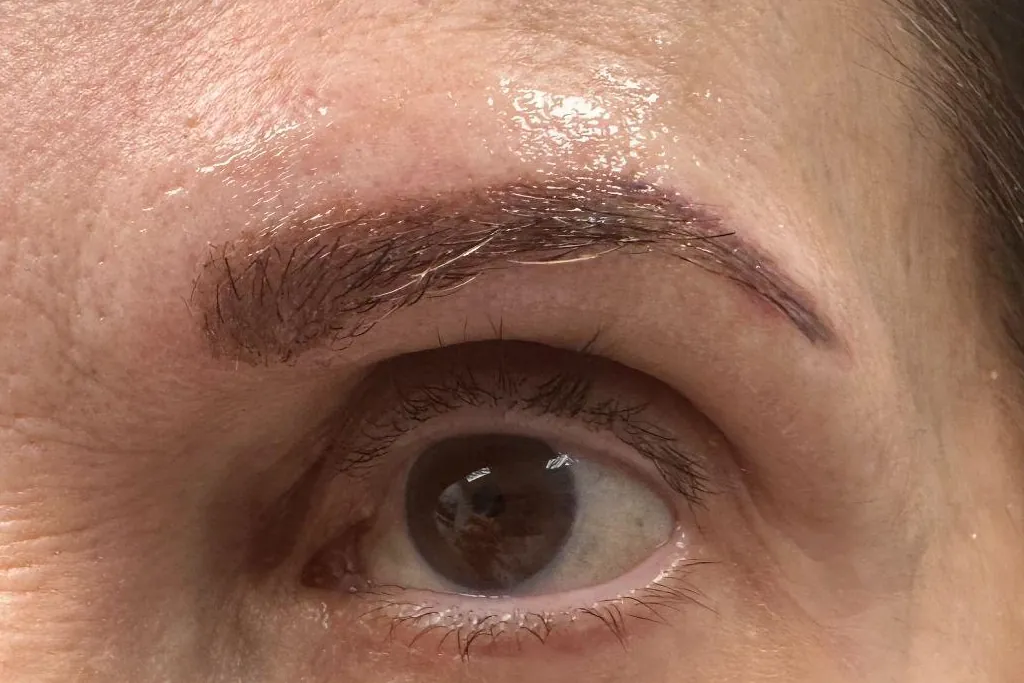 After: the same eyebrow immediately after the procedure, fuller and more defined