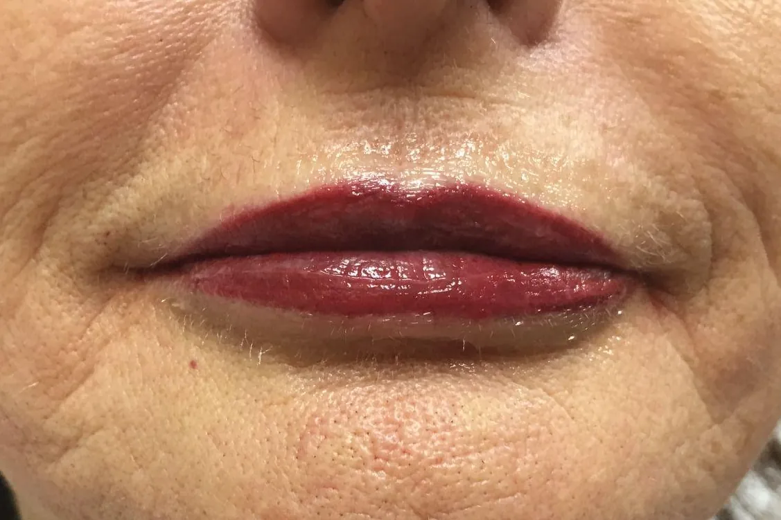 After: the same lips immediately after full lip color, now deep red, evenly colored and defined