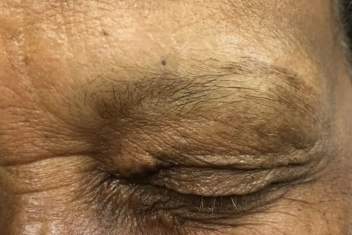 Before: a client's sparse, thin eyebrow with the eye closed