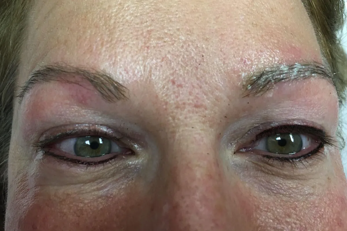 Before: a client's light, sparse eyebrows
