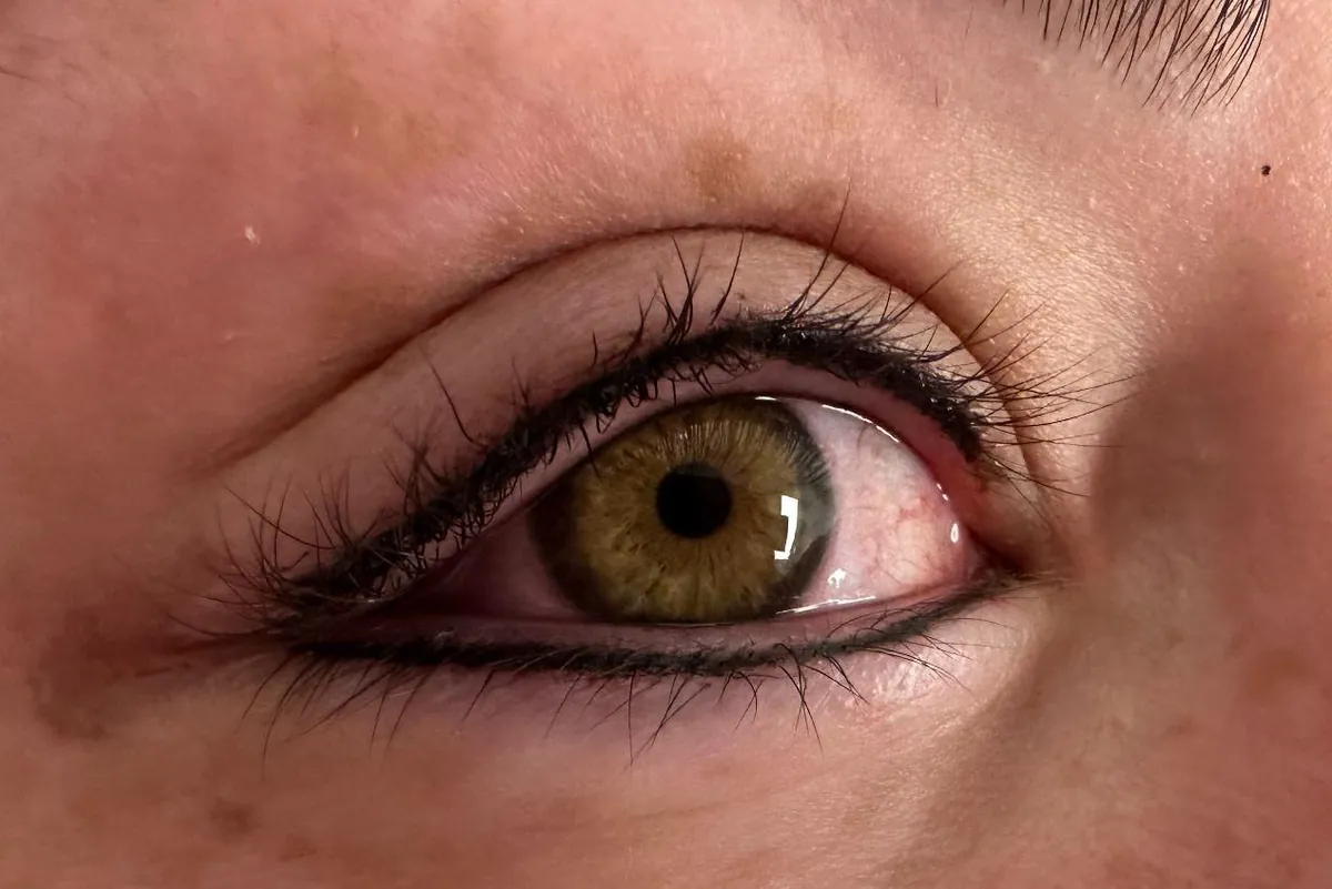 After: the same eye with permanent eyeliner along the upper and lower lash lines