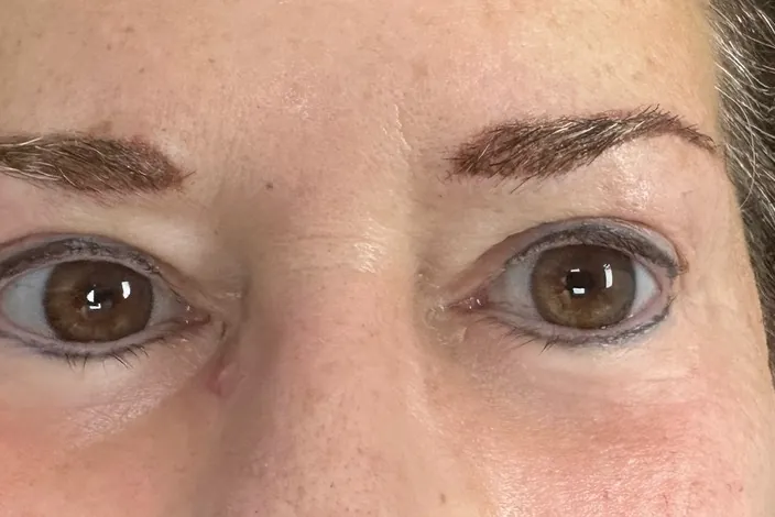 After: the same client's eyes open, with permanent eyeliner along the upper and lower lash lines