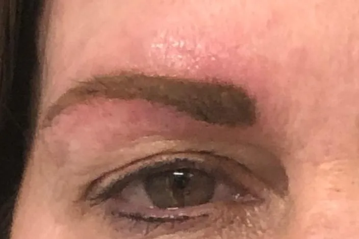 After: the same brow immediately after the procedure, rebuilt as a full, soft, shaded arch in warm brown