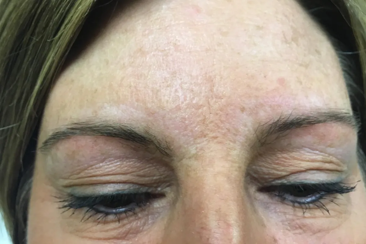 Before: a client's faint, light brows, eyes lowered