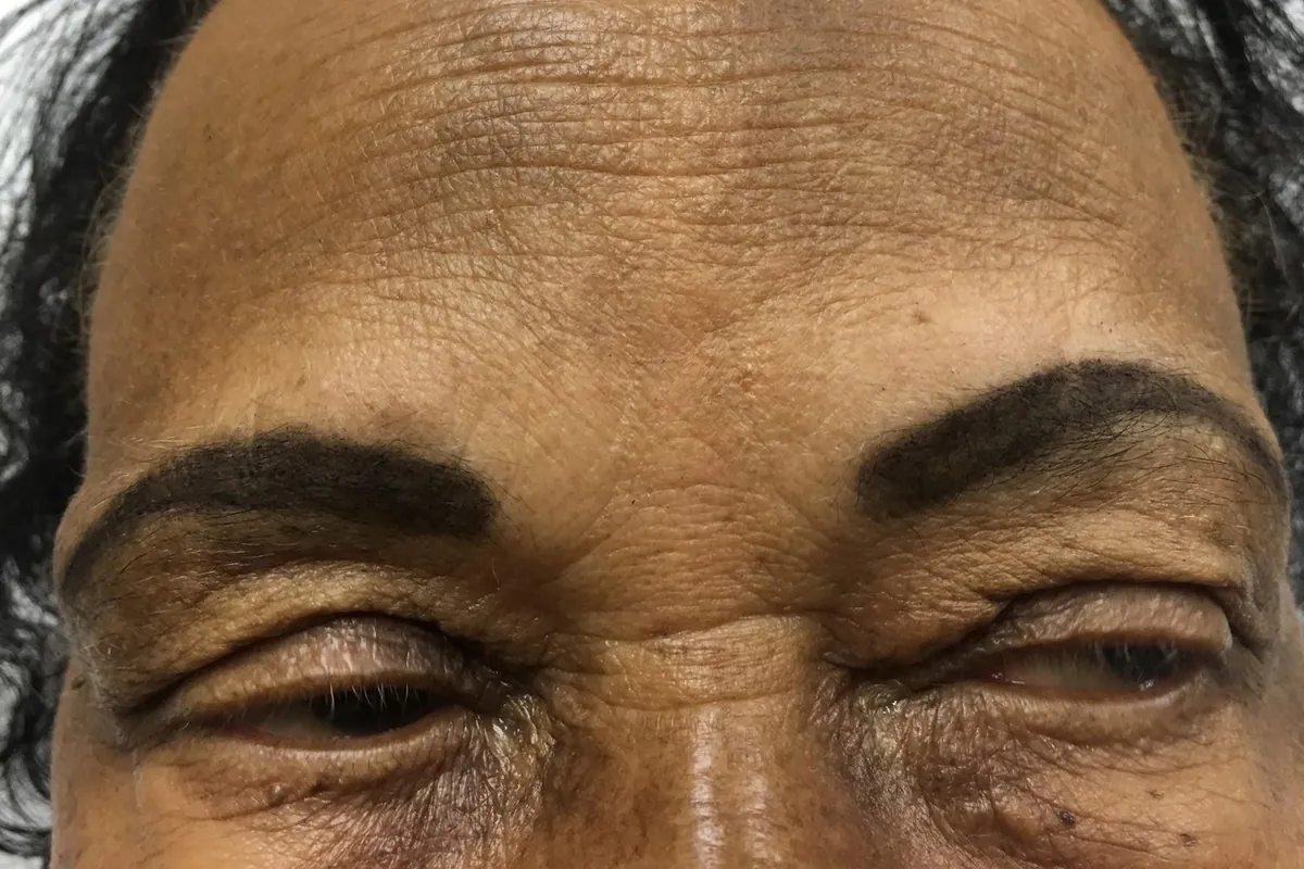 After: the same client's brows immediately after the procedure, fuller and dark brown, eyes closed